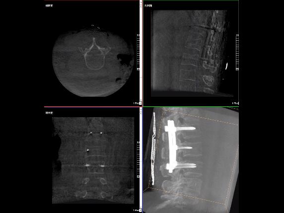 【醫(yī)療科普】2分鐘帶你了解高質量X光片的標準是什么？